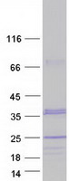 Coomassie blue staining of purified CHMP1A protein