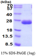 protq9jjn1 sdspage mouse fgf 21 recombinant protein