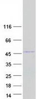 protq9np08 hmx1 human recombinant protein