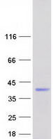 protq9np64 zcchc17 human recombinant protein