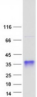protq9np77 ssu72 human recombinant protein
