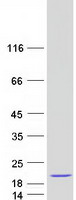 Coomassie blue staining of purified CABP5 protein