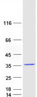 protq9np90 rab9b human recombinant protein
