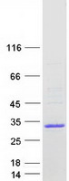 Coomassie blue staining of purified CABP2 protein