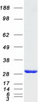 protq9npd8 hspc150 ube2t human recombinant protein