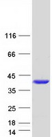 protq9nq88 tigar human recombinant protein