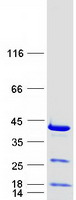 Coomassie blue staining of purified RPRD1B protein