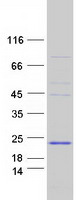 protq9nqw5 prdm7 human recombinant protein