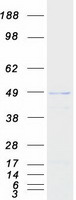 Coomassie blue staining of purified PRMT8 protein