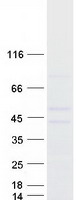 protq9nrb3 chst12 human recombinant protein