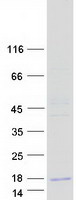 Coomassie blue staining of purified OTOR protein