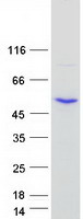 Coomassie blue staining of purified SMYD2 protein