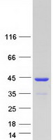 protq9nrn7 aasdhppt human recombinant protein