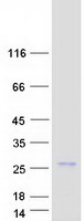 protq9ns18 glutaredoxin 2 glrx2 human recombinant protein