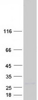Coomassie blue staining of purified RPRM protein