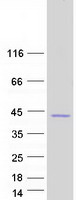protq9ns85 carbonic anhydrase x ca10 human recombinant protein