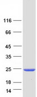 Coomassie blue staining of purified CENPM protein