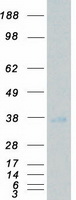 protq9nsy0 nrbp2 human recombinant protein