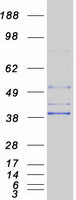 Coomassie blue staining of purified AGPAT5 protein