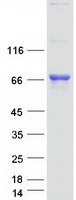 Coomassie blue staining of purified TDP1 protein