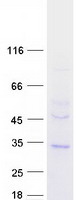 Coomassie blue staining of purified TMEM38B protein