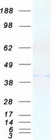 protq9nwb1 rbfox1 human recombinant protein