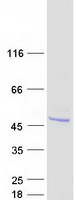 Coomassie blue staining of purified ASB6 protein
