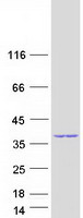 Coomassie blue staining of purified GEMIN8 protein