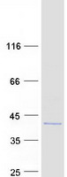 protq9nx31 c20orf111 oser1 human recombinant protein