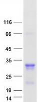 protq9nx70 med29 human recombinant protein