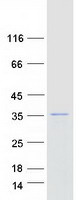 Coomassie blue staining of purified ARHGEF38 protein