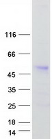 Coomassie blue staining of purified ANKRD10 protein
