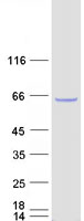 protq9nxv6 cdkn2aip human recombinant protein