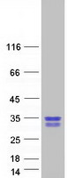 protq9ny12 nola1 gar1 human recombinant protein