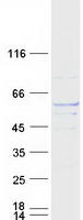 protq9ny65 tuba8 human recombinant protein