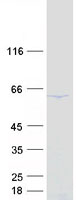Coomassie blue staining of purified DDX56 protein