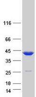 Coomassie blue staining of purified TMOD3 protein