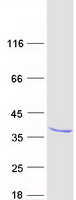 protq9nyn1 rasl12 human recombinant protein