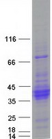 protq9nyp8 c21orf62 human recombinant protein