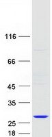 protq9nyr9 nkiras2 human recombinant protein