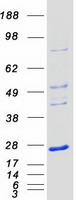 protq9nys0 nkiras1 human recombinant protein
