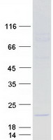 Coomassie blue staining of purified IL20 protein