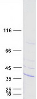 Coomassie blue staining of purified SPG21 protein