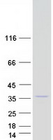 Coomassie blue staining of purified COQ3 protein