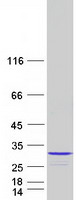 Coomassie blue staining of purified NUDT4 protein
