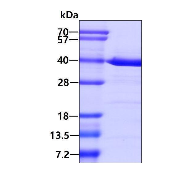 protq9nzl9 sdspage human mat ii beta recombinant protein_1