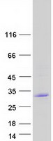 Coomassie blue staining of purified CABP1 protein