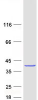 Coomassie blue staining of purified CWC15 protein