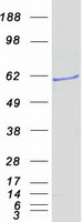 Coomassie blue staining of purified PDP1 protein