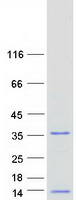 Coomassie blue staining of purified MRPL36 protein